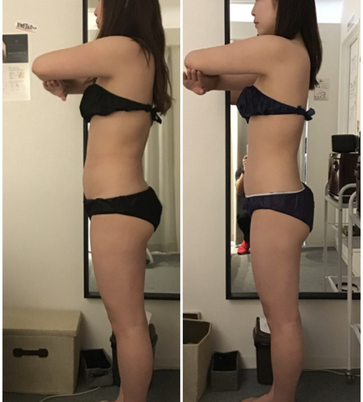 CASE 03 Before After
